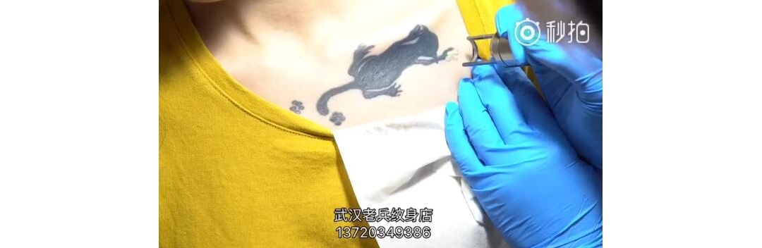 锁骨黑色猫咪皮秒洗纹身效果视频
