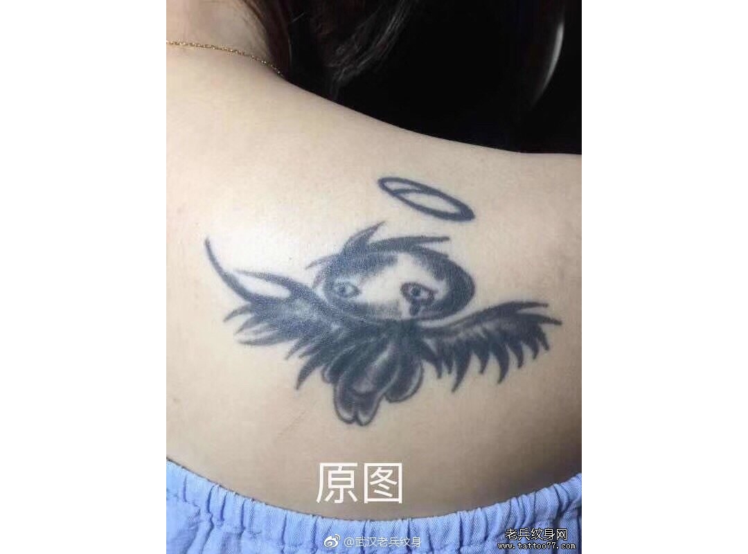 武汉皮秒激光洗纹身妹子后背天使纹身第二次洗纹身效果