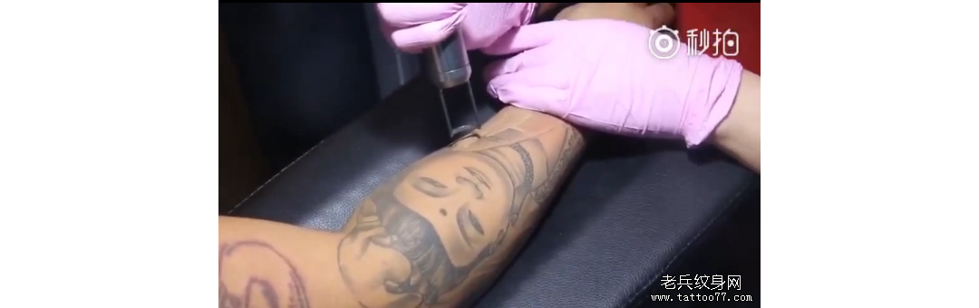 武汉皮秒激光洗纹身：花臂洗纹身过程