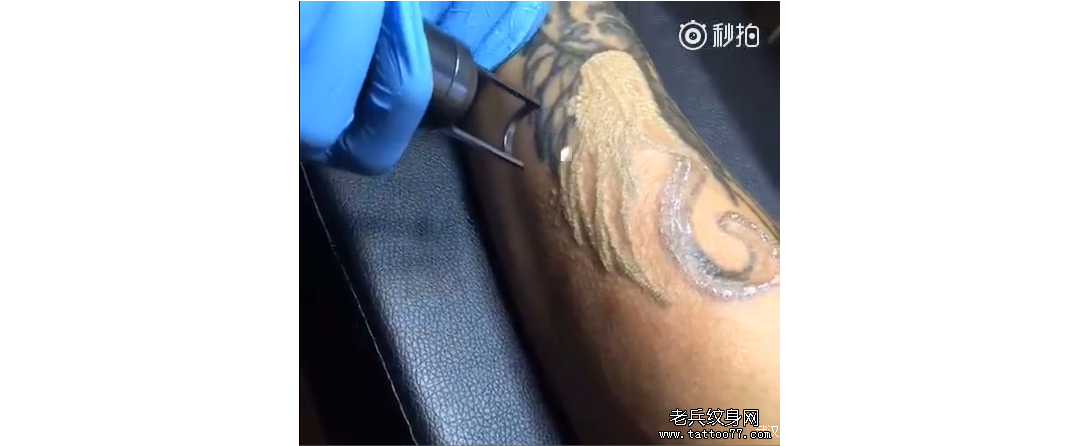 武汉激光皮秒洗纹身：手部貔貅皮秒洗纹身效果
