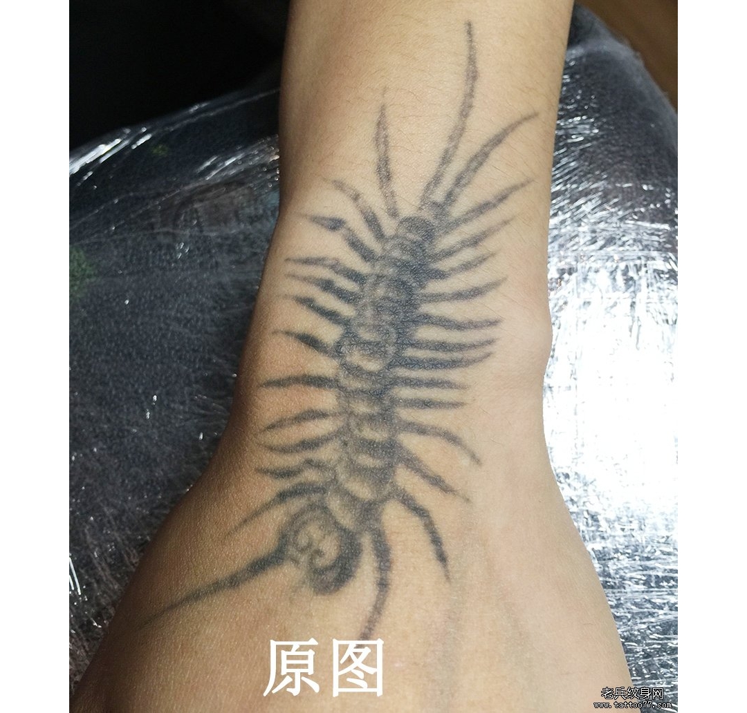 武汉最好的洗纹身店手部黑色蜈蚣皮秒洗纹身效果对比案例