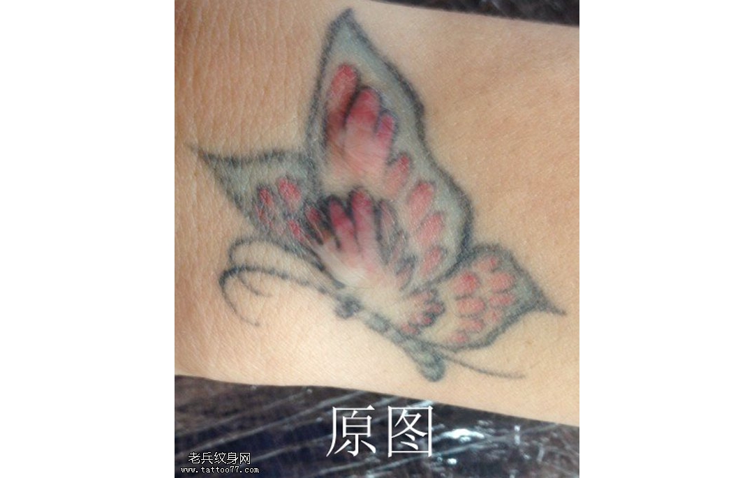 手部彩色蝴蝶专业皮秒洗纹身效果案例