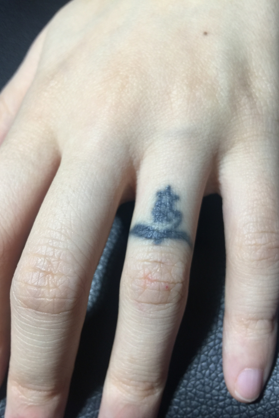 手指黑色最好的皮秒洗纹身案例
