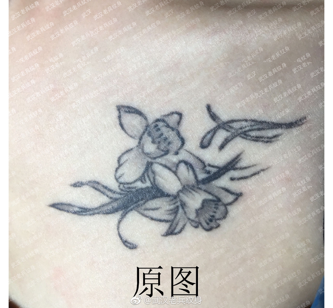武汉老兵洗纹身店带来黑色花卉洗纹身对比效果案例