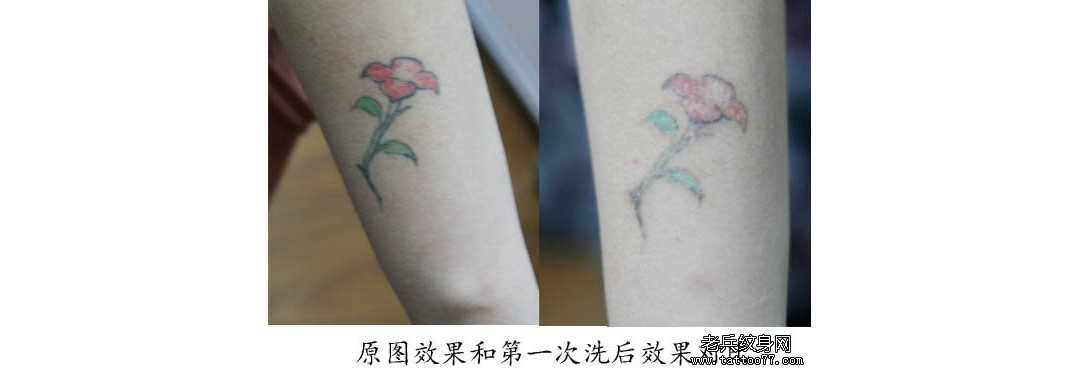 武汉老兵洗纹身店介绍最新彩色洗纹身效果案例