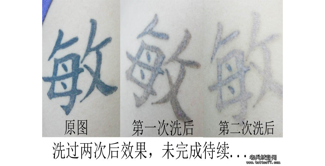 大臂图腾汉字洗纹身效果案例对比图片