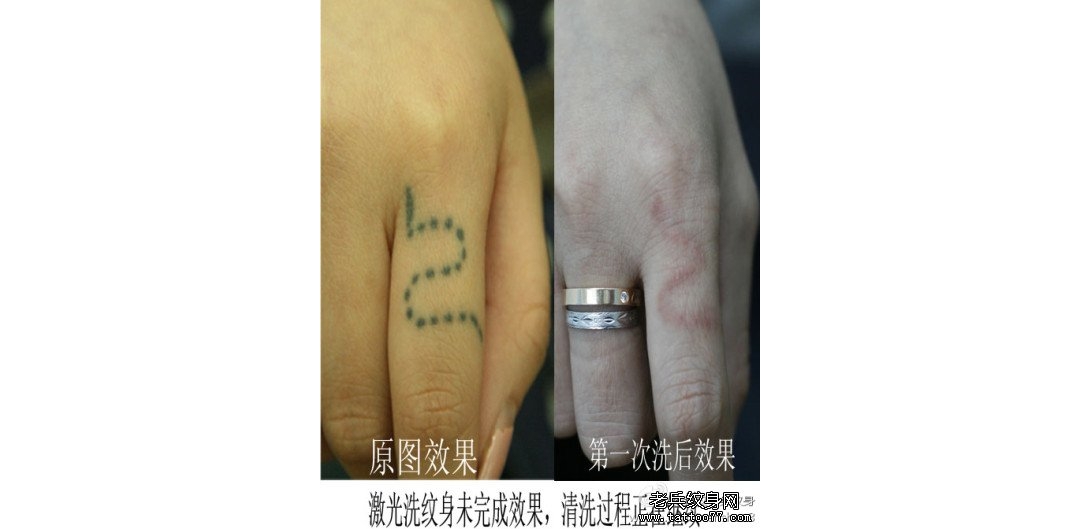 手指黑色纹身图案洗纹身步骤案例