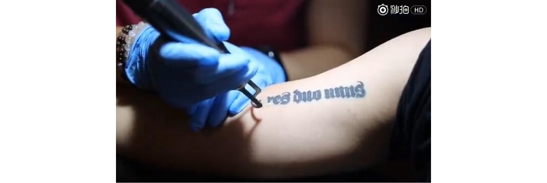 武汉专业皮秒洗纹身：手臂字母黑色洗纹身案例