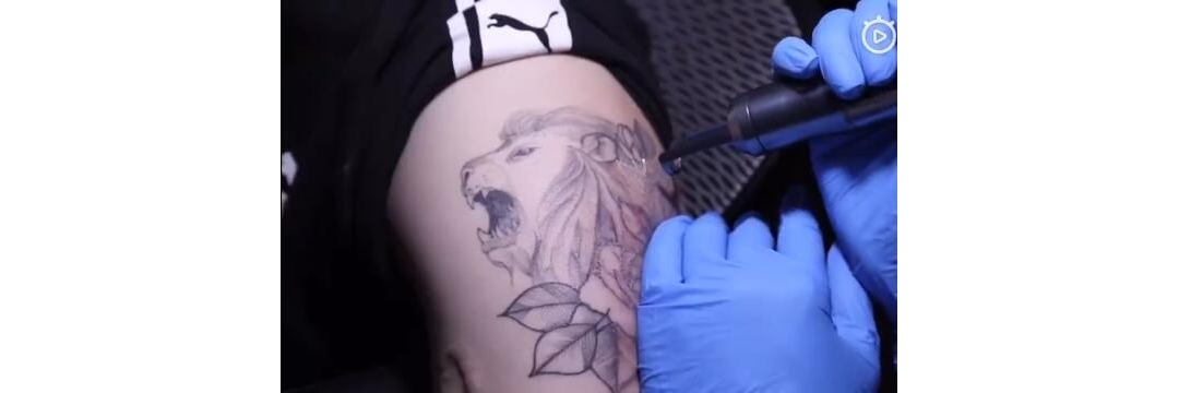 来自武汉的小哥哥，狮子纹身图案皮秒洗纹身效果案例