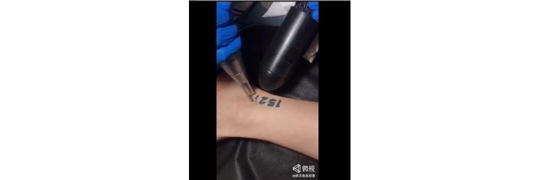 脚踝数字纹身皮秒洗纹身2分钟结束