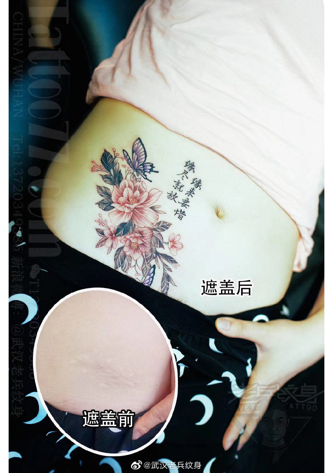 经典中国风花卉蝴蝶遮盖疤痕