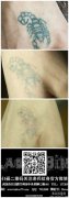 武汉洗纹身怎么样?要怎样才能洗掉身上的纹身？