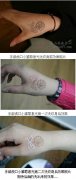 激光洗文身的疼痛是几级？？