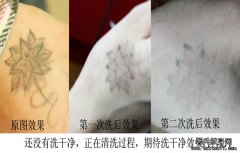 激光洗纹身是怎么让纹身颜色变淡或完全变没