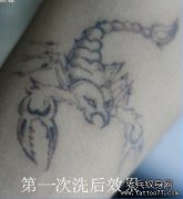 武汉最专业的洗纹身店告诉你祛纹身为什么要间隔两到三个月？
