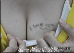 武汉彩色激光洗纹身店带你了解彩色纹身可以洗掉吗？