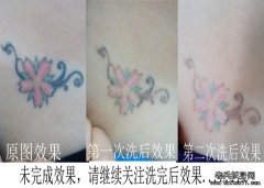 在武汉洗一个纹身需要多少钱呢？