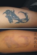 洗纹身中哪个些颜色最难洗，大概要几次才能洗干净？