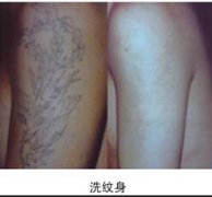 洗纹身多少钱是什么价格—武汉最好想洗纹身店为你提供洗纹身价格