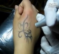 激光洗纹身具有哪些优势和后期护理