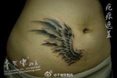 女人腹部疤痕遮盖—翅膀纹身图案