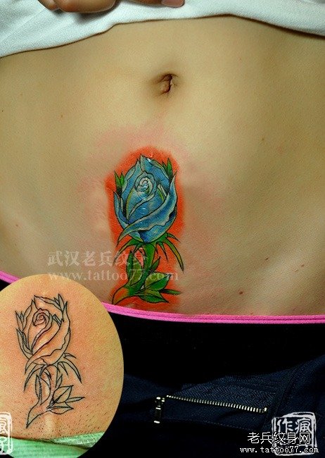 彩色玫瑰花纹身图案作品遮盖剖腹产疤痕由武汉纹身师疯子制作