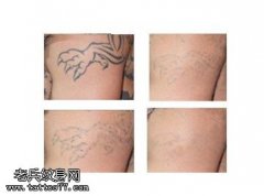 纹身过后，后悔了的办法