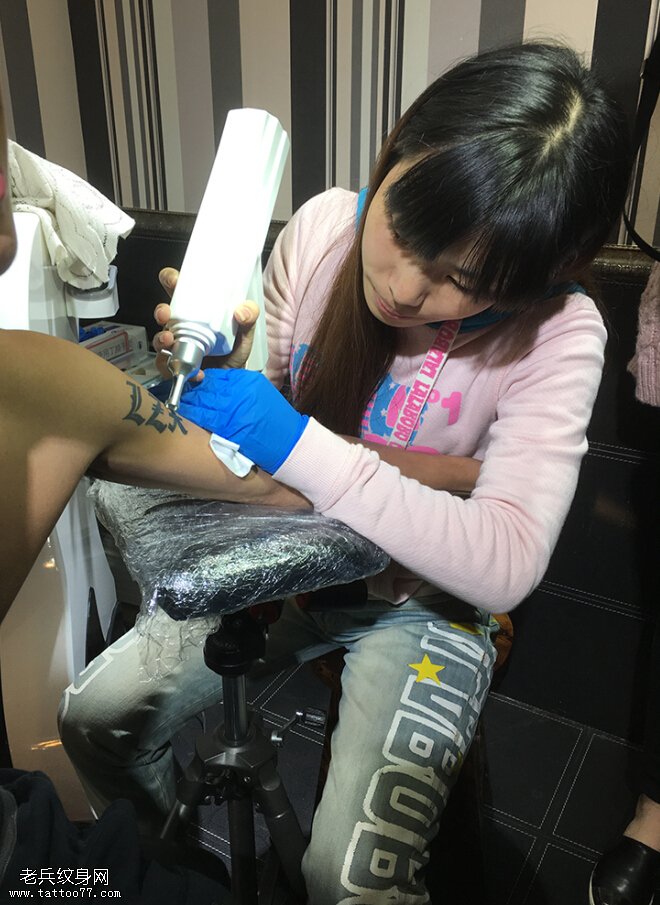 武汉专业激光洗纹身案例