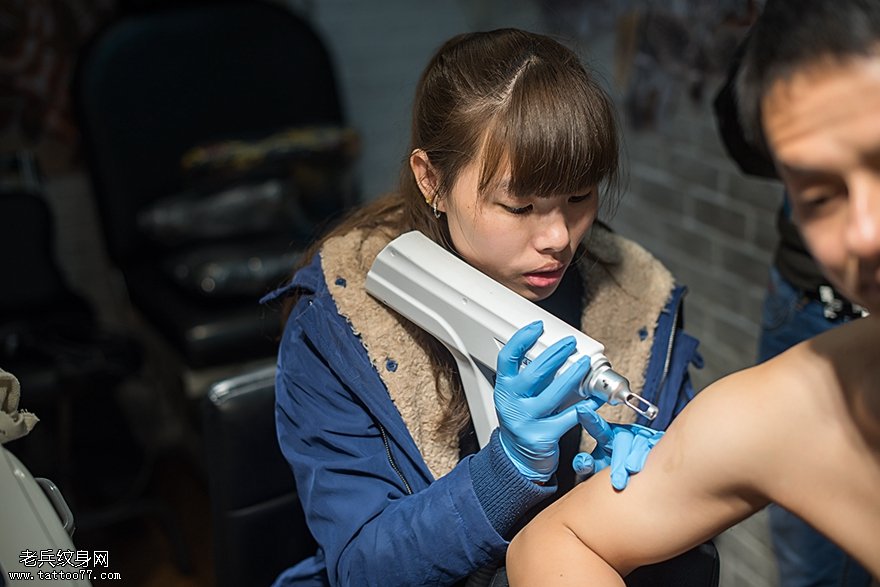 武汉最好的洗纹身店激光洗纹身过程