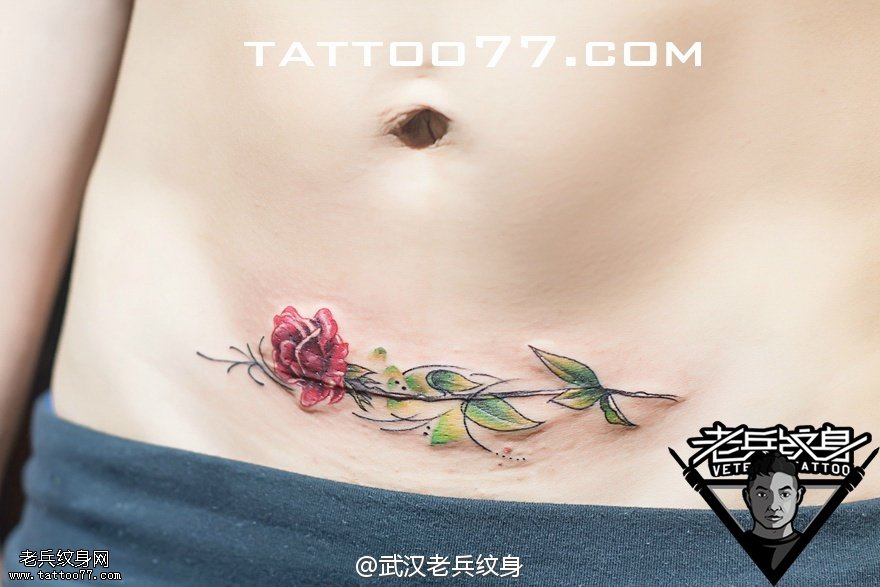 腹部玫瑰花纹身图案作品遮盖剖腹产疤痕