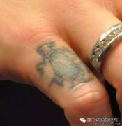 洗纹身如何预防疤痕？