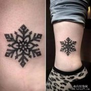 感情深 去纹身