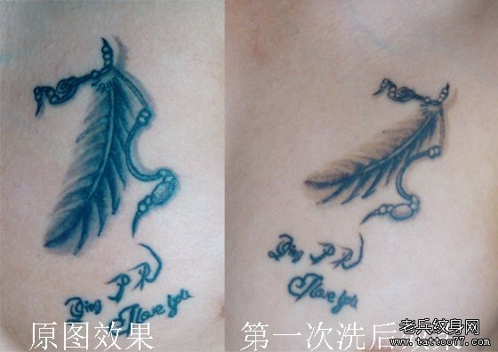 黑色羽毛纹身图案专业激光洗纹身案例及护理方法