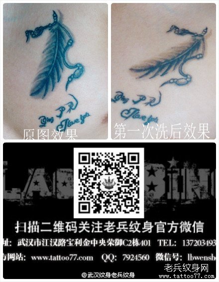 胸口羽毛激光洗文身案例