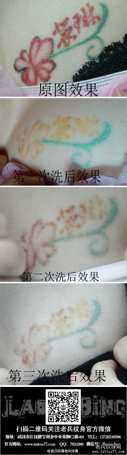 最好的激光洗纹身店揭秘彩色纹身用激光能不能洗干净?