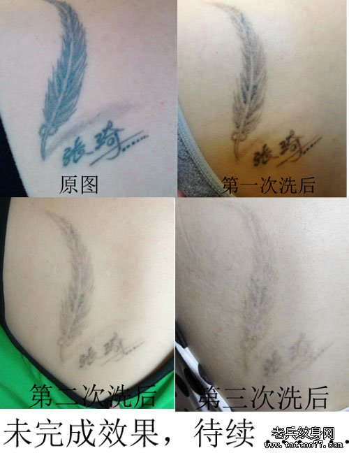 肩背羽毛汉字黑色激光洗纹身效果图案